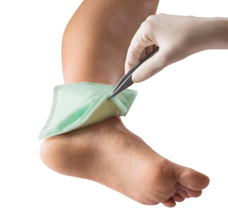 Superabsorpční krytí Zetuvit Plus Silicone - 8x8 cm, 10ks