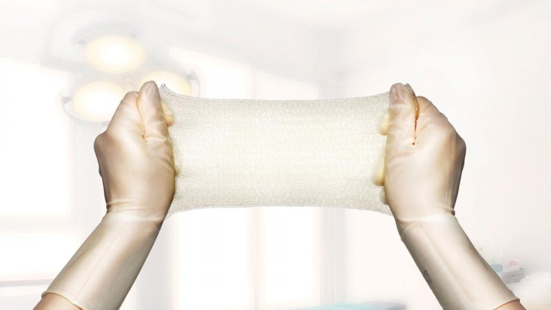 Exufiber - 5 x 5 cm, 0 ks - Vysoce absorpční krytí z hydrovlákna
