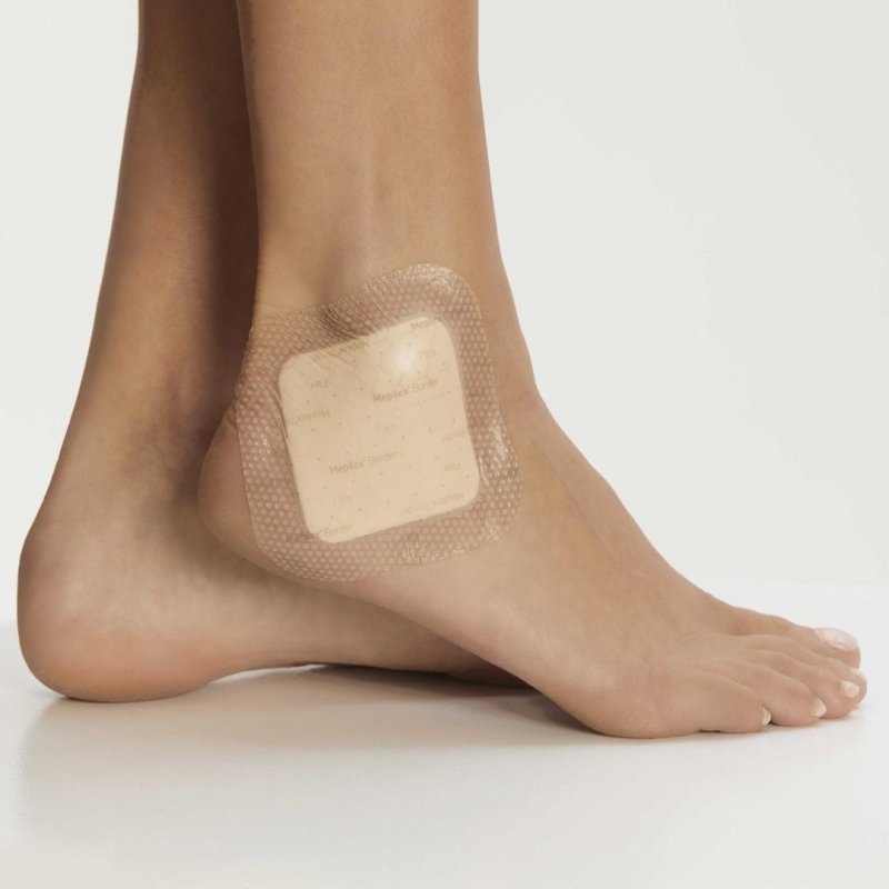 Mepilex Border Flex Lite - 5 x 12,5 cm, 5 ks - Tenké samolepící pěnové krytí se silikonovou vrstvou